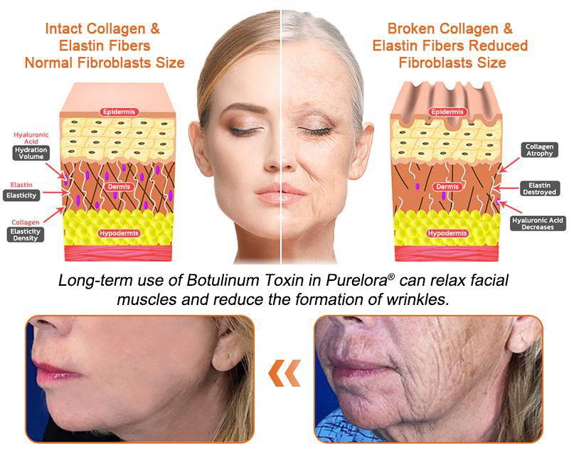 🇺🇸Official Pharmacy🇺🇸 |✨Purelora® Botox Bee Venom Firming Serum Stick