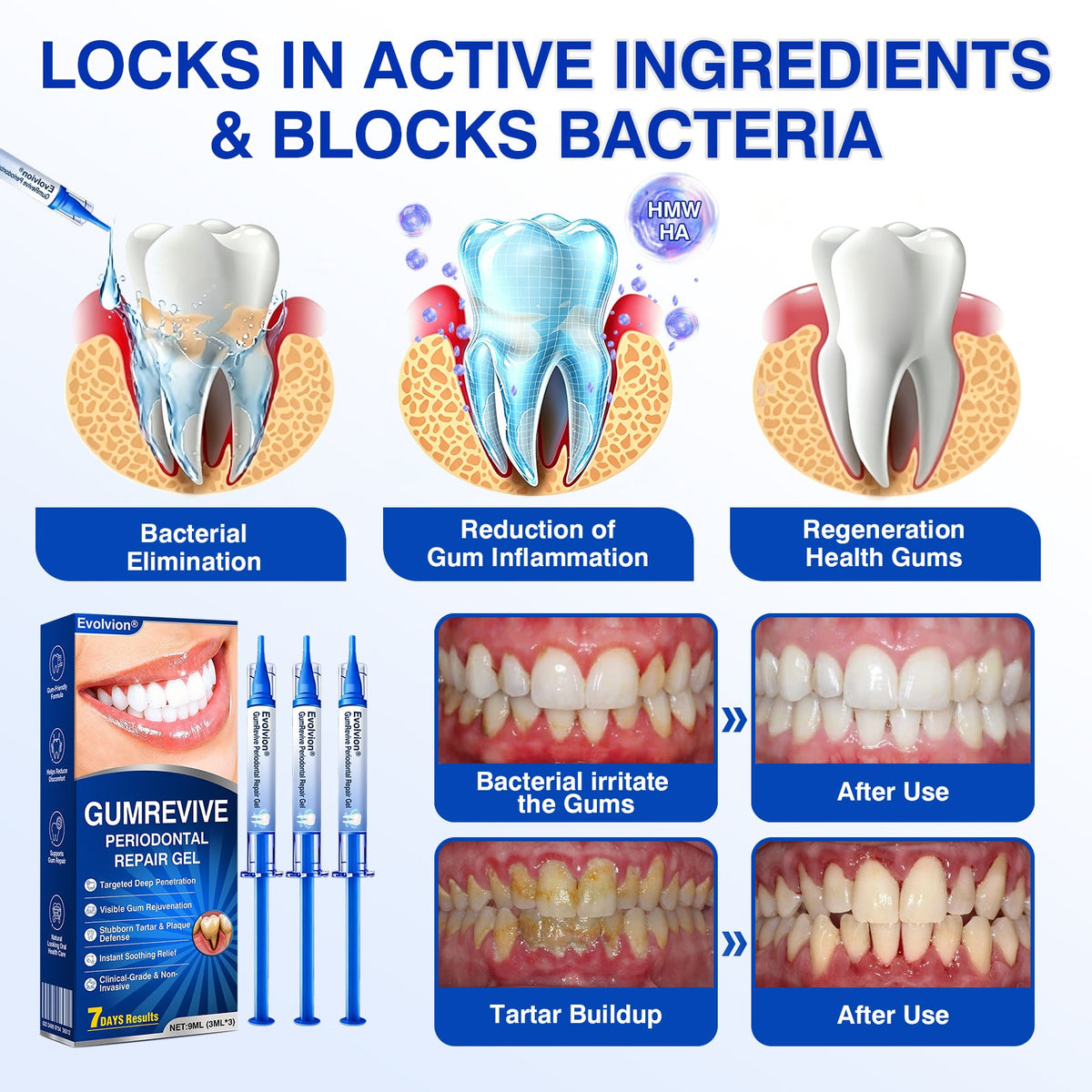 🇺🇸🏅🦷🛡️GumRevive Periodontal Repair Gel