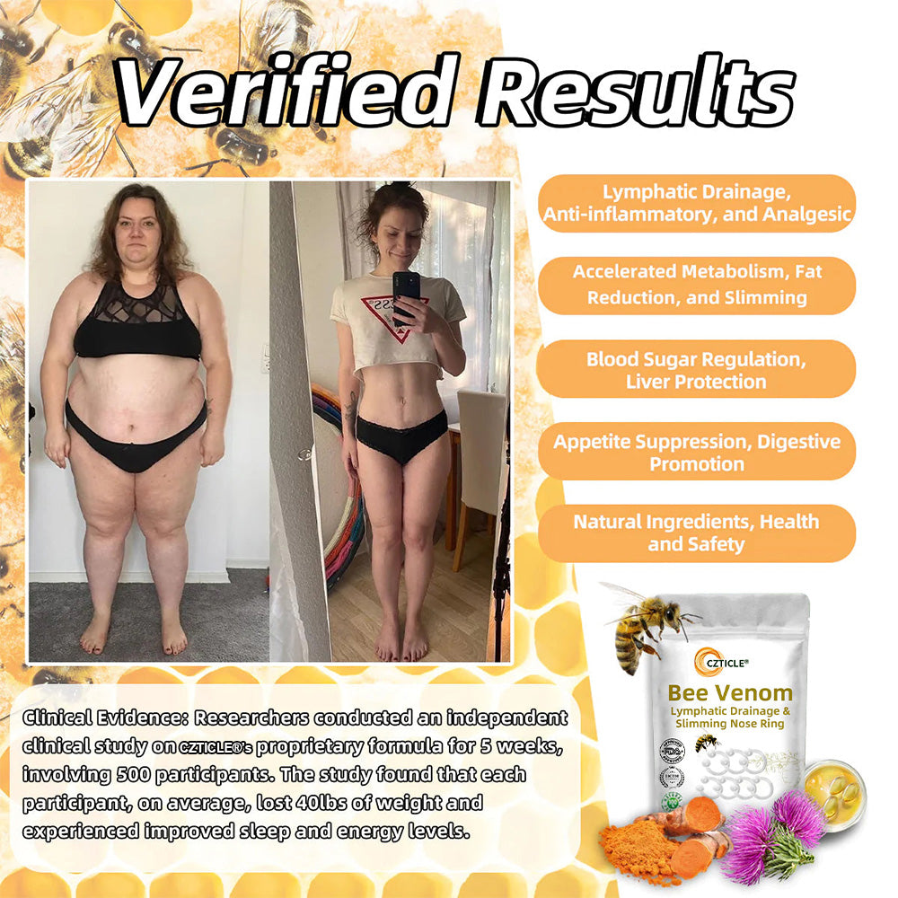 CZTICLE® 🐝Bee Venom Lymphatic Drainage & Slimming Nose Ring 🔥 (for all lymphatic problems and obesity)