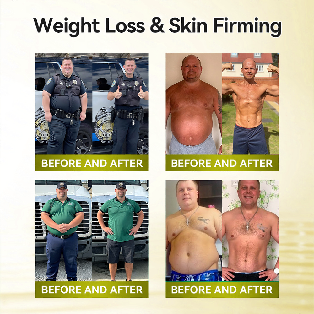 🔥 𝑵𝒆𝒘 𝑨𝒓𝒓𝒊𝒗𝒂𝒍𝒔｜Curalona® 10-in-1 Metabolic Slimming Patch Bee Venom · Berberine · Astaxanthin Detox Formula   （Visible Body Contour • Water Retention Relief • Cellulite Smoothing • Metabolic Activation ） 7-Day Lymphatic Detox & Fat-Burn Program