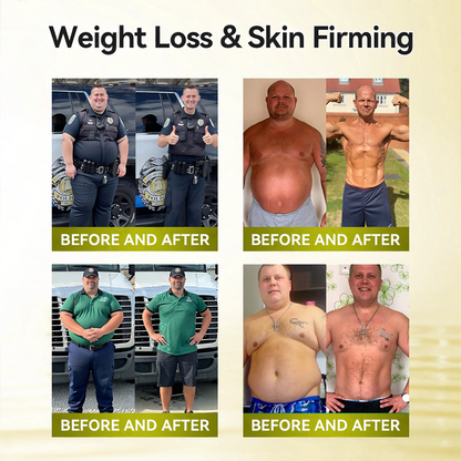 🔥 𝑵𝒆𝒘 𝑨𝒓𝒓𝒊𝒗𝒂𝒍𝒔｜Curalona® 10-in-1 Metabolic Slimming Patch Bee Venom · Berberine · Astaxanthin Detox Formula   （Visible Body Contour • Water Retention Relief • Cellulite Smoothing • Metabolic Activation ） 7-Day Lymphatic Detox & Fat-Burn Program