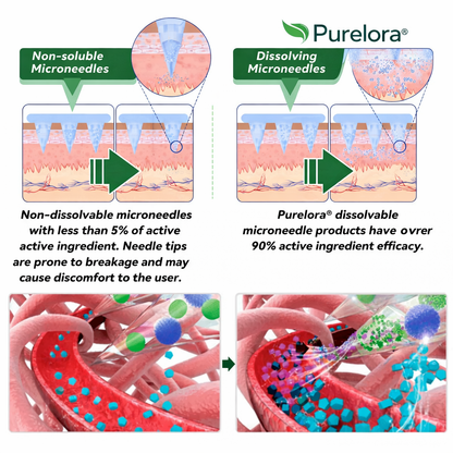 🇺🇸𝑶𝒇𝒇𝒊𝒄𝒊𝒂𝒍-𝑺𝒕𝒐𝒓𝒆 | 🍃purelora® 10-𝑰𝑵-1 𝑨𝒅𝒗𝒂𝒏𝒄𝒆𝒅 𝑵𝒂𝒏𝒐 𝑴𝒊𝒄𝒓𝒐𝒏𝒆𝒆𝒅𝒍𝒆 𝑷𝒂𝒕𝒄𝒉 (𝐎𝐧𝐜𝐞 𝐃𝐚𝐢𝐥𝐲, 𝐯𝐢𝐬𝐢𝐛𝐥𝐞 𝐜𝐡𝐚𝐧𝐠𝐞𝐬 𝐢𝐧 𝟕 𝐝𝐚𝐲𝐬）✅ 𝐎𝐛𝐞𝐬𝐢𝐭𝐲, 𝐃𝐢𝐚𝐛𝐞𝐭𝐞𝐬, 𝐒𝐥𝐞𝐞𝐩 𝐀𝐩𝐧𝐞𝐚, 𝐀𝐧𝐝 𝐉𝐨𝐢𝐧𝐭 𝐈𝐬𝐬𝐮𝐞𝐬