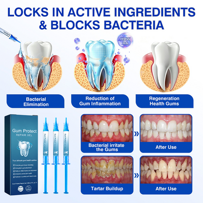 🇺🇸🏅🦷🛡️Evolvion® GumRevive Periodontal Repair Gel