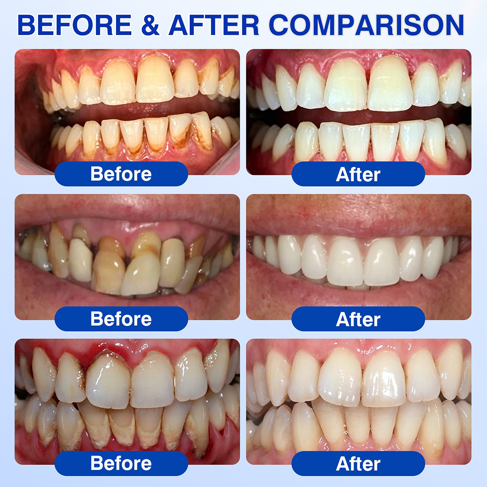 🇺🇸🏅🦷🛡️Evolvion® GumRevive Periodontal Repair Gel