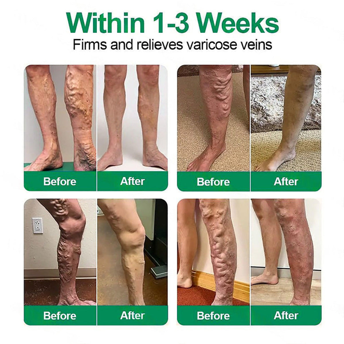 🧑‍⚕️𝐎𝐟𝐟𝐢𝐜𝐢𝐚𝐥 𝐔𝐒 𝐒𝐭𝐨𝐫𝐞 | 🧑‍⚕️𝐏𝐮𝐫𝐞𝐥𝐨𝐫𝐚® 𝐁𝐞𝐞 𝐕𝐞𝐧𝐨 𝐕𝐄𝐍𝐄-𝐇𝐄𝐀𝐋 𝐱 𝐍𝐀𝐃+ 𝐁𝐄𝐑𝐁𝐄𝐑𝐈𝐍𝐄 𝟏𝟐-𝐢𝐧-𝟏 𝐀𝐝𝐯𝐚𝐧𝐜𝐞𝐝 𝐍𝐚𝐧𝐨 𝐌𝐢𝐜𝐫𝐨𝐧𝐞𝐞𝐝𝐥𝐞 𝐏𝐚𝐭𝐜𝐡 — 𝐎𝐧𝐜𝐞 𝐃𝐚𝐢𝐥𝐲, 𝐕𝐢𝐬𝐢𝐛𝐥𝐞 𝐑𝐞𝐬𝐮𝐥𝐭𝐬 𝐢𝐧 𝟕 𝐃𝐚𝐲𝐬